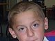 Duchenne muscular dystrophy