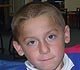 Duchenne muscular dystrophy
