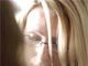 Is epilepsy a hidden disability?