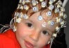 Autism may be detected as early as six months