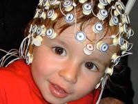 Autism may be detected as early as six months