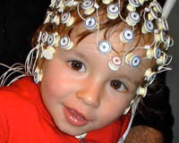 Autism may be detected as early as six months