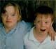 The politics of Down syndrome