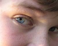 Nowhere to turn for teenage self-harmers Young people do not know who to talk to about self-harm.