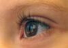 New research into nystagmus launched