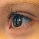 nystagmus0113