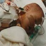 Oliver at three and a half months, following cardiac surgery.