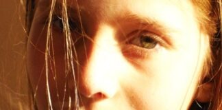 ADHD linked to economic status